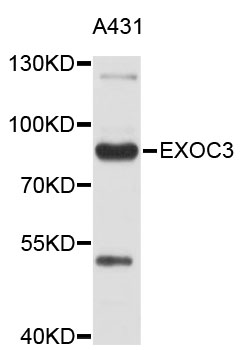 EXOC3 / SEC6 Antibody - Western blot analysis of extracts of A431 cells.