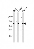EXOC4 / SEC8 Antibody - All lanes : Anti-EXOC4 Antibody at 1:2000 dilution Lane 1: HeLa whole cell lysates Lane 2: Jurkat whole cell lysates Lane 3: MCF-7 whole cell lysates Lysates/proteins at 20 ug per lane. Secondary Goat Anti-Rabbit IgG, (H+L), Peroxidase conjugated at 1/10000 dilution Predicted band size : 110 kDa Blocking/Dilution buffer: 5% NFDM/TBST.