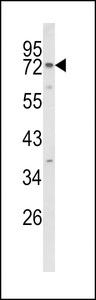 EXOC5 Antibody - Western blot of EXOC5 Antibody in NCI-H460 cell line lysates (35 ug/lane). EXOC5 (arrow) was detected using the purified antibody.