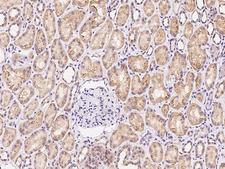EXOC5 Antibody - Immunochemical staining EXOC5 in human kidney with rabbit polyclonal antibody at 1:1000 dilution, formalin-fixed paraffin embedded sections.