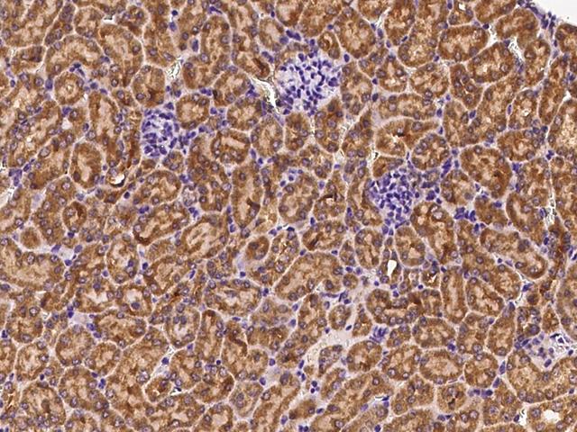 EXOC5 Antibody - Immunochemical staining EXOC5 in mouse kidney with rabbit polyclonal antibody at 1:1000 dilution, formalin-fixed paraffin embedded sections.