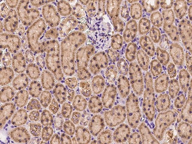 EXOC5 Antibody - Immunochemical staining EXOC5 in rat kidney with rabbit polyclonal antibody at 1:1000 dilution, formalin-fixed paraffin embedded sections.