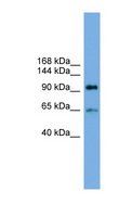 EXOC6 / SEC15 Antibody - EXOC6 antibody Western blot of Fetal Small Intestine lysate. This image was taken for the unconjugated form of this product. Other forms have not been tested.