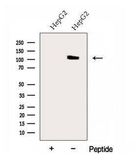 EXOC6 / SEC15 Antibody - Western blot analysis of extracts of HepG2 cells using EXOC6 antibody. The lane on the left was treated with blocking peptide.