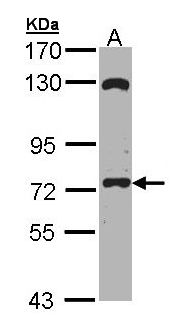 EXOC7 Antibody - Sample (30 ug of whole cell lysate). A: Molt-4 . 7.5% SDS PAGE. EXOC7 antibody diluted at 1:1000.