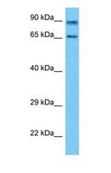 EXOC7 Antibody - Western blot of EXOC7 Antibody with human PANC1 Whole Cell lysate.  This image was taken for the unconjugated form of this product. Other forms have not been tested.