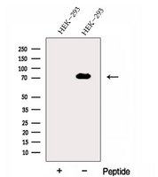 EXOC7 Antibody - Western blot analysis of extracts of 3T3 cells using Exo70 antibody. The lane on the left was treated with blocking peptide.