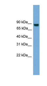 EXOC8 / EXO84 Antibody - EXOC8 / EXO84 antibody Western blot of Jurkat lysate. This image was taken for the unconjugated form of this product. Other forms have not been tested.