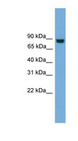 EXOC8 / EXO84 Antibody - EXOC8 / EXO84 antibody Western blot of Jurkat lysate. This image was taken for the unconjugated form of this product. Other forms have not been tested.