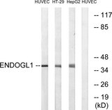 EXOG / ENDOGL1 Antibody - Western blot analysis of lysates from HUVEC, HT-29, and HepG2 cells, using ENDOGL1 Antibody. The lane on the right is blocked with the synthesized peptide.