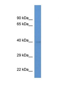 EXOG / ENDOGL1 Antibody - EXOG / ENDOGL1 antibody Western blot of Mouse Kidney lysate. Antibody concentration 1 ug/ml. This image was taken for the unconjugated form of this product. Other forms have not been tested.