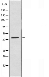 EXOG / ENDOGL1 Antibody - Western blot analysis of extracts of HuvEc cells using ENDOGL1 antibody.