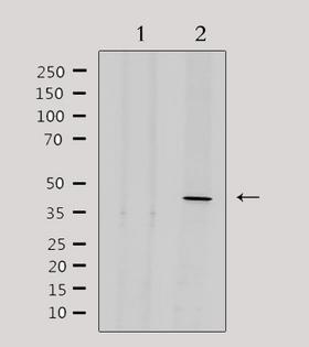 EXOG / ENDOGL1 Antibody - Western blot analysis of extracts of 293 cells using ENDOGL1 antibody. Lane 1 was treated with the antigen-specific peptide.