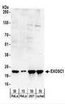 EXOSC1 / CSL4 Antibody - Detection of Human EXOSC1 by Western Blot. Samples: Whole cell lysate from HeLa (15 and 50 ug), 293T (50 ug), and Jurkat (50 ug) cells. Antibodies: Affinity purified rabbit anti-EXOSC1 antibody used for WB at 0.4 ug/ml. Detection: Chemiluminescence with an exposure time of 3 minutes.