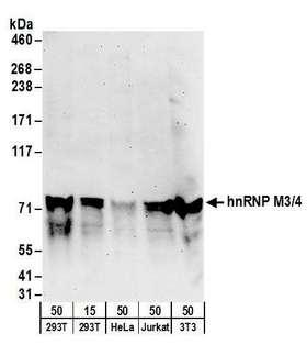 EXOSC1 / CSL4 Antibody - Detection of human and mouse hnRNP M3/4 by western blot. Samples: Whole cell lysate from HEK293T (15 and 50 µg), HeLa (50µg), Jurkat (50µg), and mouse NIH 3T3 (50µg) cells. Antibodies: Affinity purified rabbit anti-hnRNP M3/4 antibody used for WB at 0.1 µg/ml. Detection: Chemiluminescence with an exposure time of 3 minutes.