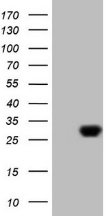 EXOSC1 / CSL4 Antibody - HEK293T cells were transfected with the pCMV6-ENTRY control (Left lane) or pCMV6-ENTRY EXOSC1 (Right lane) cDNA for 48 hrs and lysed. Equivalent amounts of cell lysates (5 ug per lane) were separated by SDS-PAGE and immunoblotted with anti-EXOSC1 (1:2000).