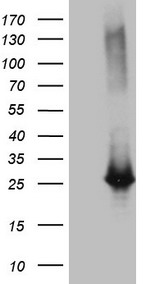 EXOSC1 / CSL4 Antibody - HEK293T cells were transfected with the pCMV6-ENTRY control. (Left lane) or pCMV6-ENTRY EXOSC1. (Right lane) cDNA for 48 hrs and lysed. Equivalent amounts of cell lysates. (5 ug per lane) were separated by SDS-PAGE and immunoblotted with anti-EXOSC1. (1:2000)