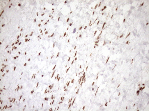 EXOSC1 / CSL4 Antibody - Immunohistochemical staining of paraffin-embedded Human Ovary tissue within the normal limits using anti-EXOSC1 mouse monoclonal antibody. (Heat-induced epitope retrieval by 1mM EDTA in 10mM Tris buffer. (pH8.5) at 120°C for 3 min. (1:150)