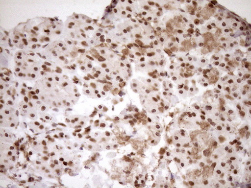 EXOSC1 / CSL4 Antibody - Immunohistochemical staining of paraffin-embedded Human pancreas tissue within the normal limits using anti-EXOSC1 mouse monoclonal antibody. (Heat-induced epitope retrieval by 1mM EDTA in 10mM Tris buffer. (pH8.5) at 120°C for 3 min. (1:150)
