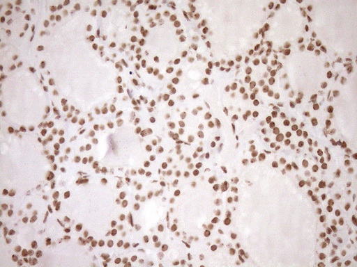 EXOSC1 / CSL4 Antibody - Immunohistochemical staining of paraffin-embedded Human thyroid tissue within the normal limits using anti-EXOSC1 mouse monoclonal antibody. (Heat-induced epitope retrieval by 1mM EDTA in 10mM Tris buffer. (pH8.5) at 120°C for 3 min. (1:150)