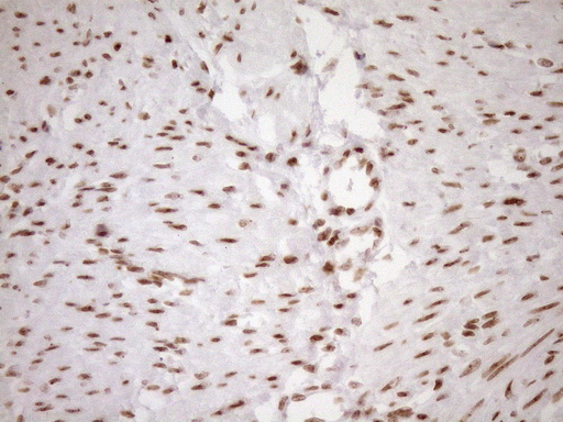 EXOSC1 / CSL4 Antibody - Immunohistochemical staining of paraffin-embedded Human endometrium tissue within the normal limits using anti-EXOSC1 mouse monoclonal antibody. (Heat-induced epitope retrieval by 1mM EDTA in 10mM Tris buffer. (pH8.5) at 120°C for 3 min. (1:150)