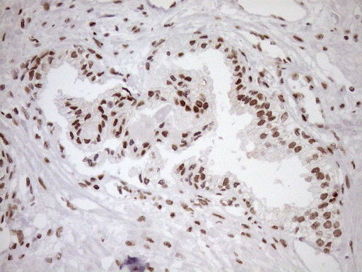 EXOSC1 / CSL4 Antibody - Immunohistochemical staining of paraffin-embedded Human prostate tissue within the normal limits using anti-EXOSC1 mouse monoclonal antibody. (Heat-induced epitope retrieval by 1mM EDTA in 10mM Tris buffer. (pH8.5) at 120°C for 3 min. (1:150)