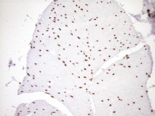 EXOSC1 / CSL4 Antibody - Immunohistochemical staining of paraffin-embedded Human bladder tissue within the normal limits using anti-EXOSC1 mouse monoclonal antibody. (Heat-induced epitope retrieval by 1mM EDTA in 10mM Tris buffer. (pH8.5) at 120°C for 3 min. (1:150)