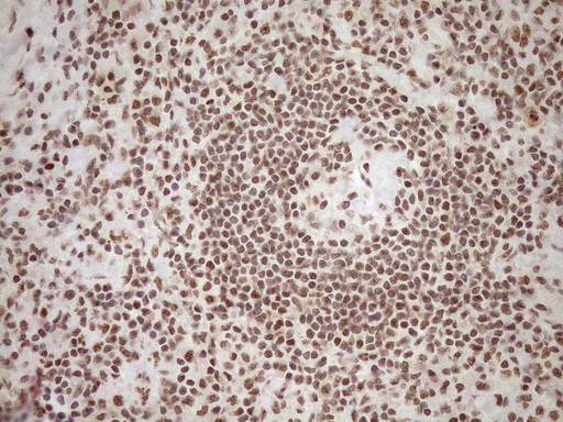 EXOSC1 / CSL4 Antibody - Immunohistochemical staining of paraffin-embedded Human lymph node tissue within the normal limits using anti-EXOSC1 mouse monoclonal antibody. (Heat-induced epitope retrieval by 1mM EDTA in 10mM Tris buffer. (pH8.5) at 120°C for 3 min. (1:150)