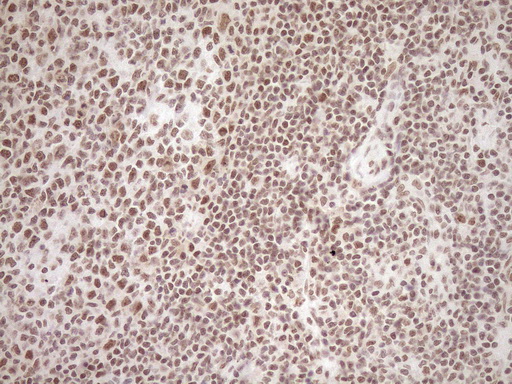 EXOSC1 / CSL4 Antibody - Immunohistochemical staining of paraffin-embedded Human tonsil within the normal limits using anti-EXOSC1 mouse monoclonal antibody. (Heat-induced epitope retrieval by 1mM EDTA in 10mM Tris buffer. (pH8.5) at 120°C for 3 min. (1:150)