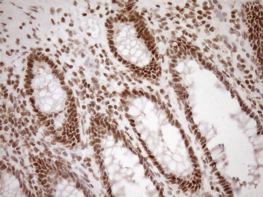 EXOSC1 / CSL4 Antibody - Immunohistochemical staining of paraffin-embedded Human colon tissue within the normal limits using anti-EXOSC1 mouse monoclonal antibody. (Heat-induced epitope retrieval by 1mM EDTA in 10mM Tris buffer. (pH8.5) at 120°C for 3 min. (1:150)