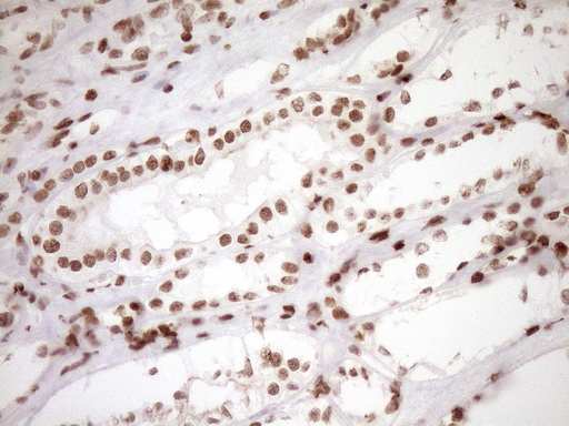 EXOSC1 / CSL4 Antibody - Immunohistochemical staining of paraffin-embedded Human Kidney tissue within the normal limits using anti-EXOSC1 mouse monoclonal antibody. (Heat-induced epitope retrieval by 1mM EDTA in 10mM Tris buffer. (pH8.5) at 120°C for 3 min. (1:150)