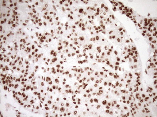 EXOSC1 / CSL4 Antibody - Immunohistochemical staining of paraffin-embedded Human liver tissue within the normal limits using anti-EXOSC1 mouse monoclonal antibody. (Heat-induced epitope retrieval by 1mM EDTA in 10mM Tris buffer. (pH8.5) at 120°C for 3 min. (1:150)