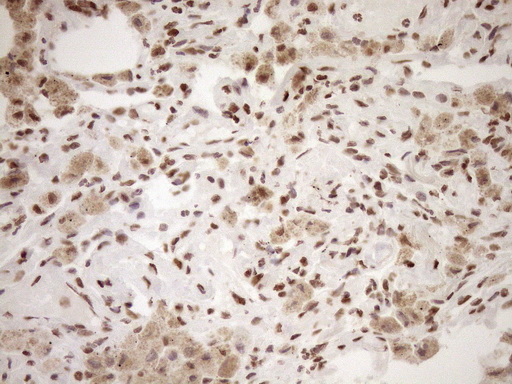 EXOSC1 / CSL4 Antibody - Immunohistochemical staining of paraffin-embedded Human lung tissue within the normal limits using anti-EXOSC1 mouse monoclonal antibody. (Heat-induced epitope retrieval by 1mM EDTA in 10mM Tris buffer. (pH8.5) at 120°C for 3 min. (1:150)