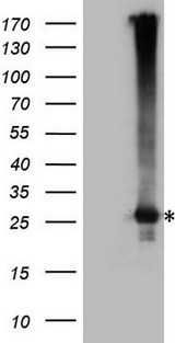 EXOSC1 / CSL4 Antibody - HEK293T cells were transfected with the pCMV6-ENTRY control. (Left lane) or pCMV6-ENTRY EXOSC1. (Right lane) cDNA for 48 hrs and lysed. Equivalent amounts of cell lysates. (5 ug per lane) were separated by SDS-PAGE and immunoblotted with anti-EXOSC1. (1:2000)