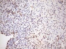 EXOSC1 / CSL4 Antibody - Immunohistochemical staining of paraffin-embedded Human Ovary tissue within the normal limits using anti-EXOSC1 mouse monoclonal antibody. (Heat-induced epitope retrieval by 1mM EDTA in 10mM Tris buffer. (pH8.5) at 120 oC for 3 min. (1:150)