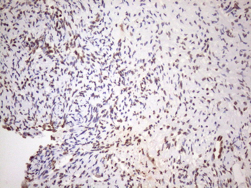 EXOSC1 / CSL4 Antibody - Immunohistochemical staining of paraffin-embedded Human Ovary tissue within the normal limits using anti-EXOSC1 mouse monoclonal antibody. (Heat-induced epitope retrieval by 1mM EDTA in 10mM Tris buffer. (pH8.5) at 120 oC for 3 min. (1:150)