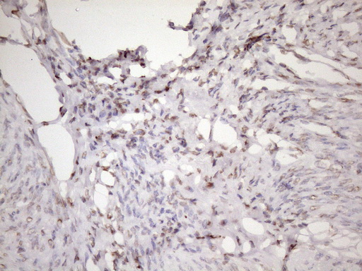EXOSC1 / CSL4 Antibody - Immunohistochemical staining of paraffin-embedded Human endometrium tissue within the normal limits using anti-EXOSC1 mouse monoclonal antibody. (Heat-induced epitope retrieval by 1mM EDTA in 10mM Tris buffer. (pH8.5) at 120 oC for 3 min. (1:150)