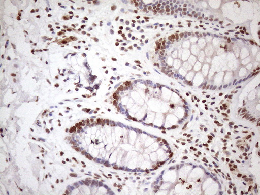 EXOSC1 / CSL4 Antibody - Immunohistochemical staining of paraffin-embedded Human colon tissue within the normal limits using anti-EXOSC1 mouse monoclonal antibody. (Heat-induced epitope retrieval by 1mM EDTA in 10mM Tris buffer. (pH8.5) at 120 oC for 3 min. (1:150)