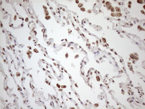 EXOSC1 / CSL4 Antibody - Immunohistochemical staining of paraffin-embedded Human lung tissue within the normal limits using anti-EXOSC1 mouse monoclonal antibody. (Heat-induced epitope retrieval by 1mM EDTA in 10mM Tris buffer. (pH8.5) at 120 oC for 3 min. (1:150)