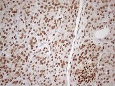 EXOSC1 / CSL4 Antibody - Immunohistochemical staining of paraffin-embedded Human pancreas tissue within the normal limits using anti-EXOSC1 mouse monoclonal antibody. (Heat-induced epitope retrieval by 1mM EDTA in 10mM Tris buffer. (pH8.5) at 120 oC for 3 min. (1:150)