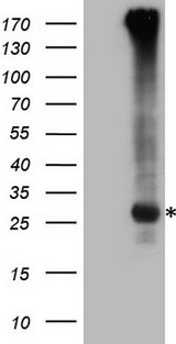 EXOSC1 / CSL4 Antibody - HEK293T cells were transfected with the pCMV6-ENTRY control. (Left lane) or pCMV6-ENTRY EXOSC1. (Right lane) cDNA for 48 hrs and lysed