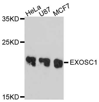 EXOSC1 / CSL4 Antibody - Western blot analysis of extracts of various cell lines, using EXOSC1 antibody at 1:1000 dilution. The secondary antibody used was an HRP Goat Anti-Rabbit IgG (H+L) at 1:10000 dilution. Lysates were loaded 25ug per lane and 3% nonfat dry milk in TBST was used for blocking. An ECL Kit was used for detection and the exposure time was 90s.