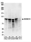 EXOSC10 Antibody - Detection of Human and Mouse EXOSC10 by Western Blot. Samples: Whole cell lysate (50 ug) from HeLa, 293T, Jurkat, mouse TCMK-1, and mouse NIH3T3 cells. Antibodies: Affinity purified rabbit anti-EXOSC10 antibody used for WB at 0.4 ug/ml. Detection: Chemiluminescence with an exposure time of 30 seconds.