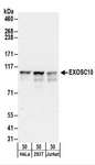 EXOSC10 Antibody - Detection of Human EXOSC10 by Western Blot. Samples: Whole cell lysate (50 ug) from HeLa, 293T, and Jurkat cells. Antibodies: Affinity purified rabbit anti-EXOSC10 antibody used for WB at 0.1 ug/ml. Detection: Chemiluminescence with an exposure time of 30 seconds.