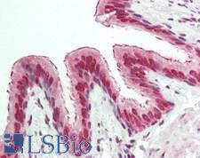 EXOSC10 Antibody - Human Lung: Formalin-Fixed, Paraffin-Embedded (FFPE).  This image was taken for the unconjugated form of this product. Other forms have not been tested.