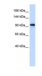 EXOSC10 Antibody - Western blot of Transfected 293T cell lysate using EXOSC10 antibody.  This image was taken for the unconjugated form of this product. Other forms have not been tested.