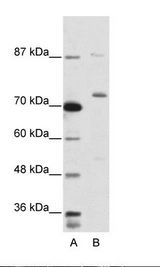 EXOSC10 Antibody - A: Marker, B: Jurkat Cell Lysate.  This image was taken for the unconjugated form of this product. Other forms have not been tested.