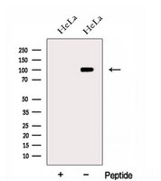 EXOSC10 Antibody - Western blot analysis of extracts of HeLa cells using EXOSC10 antibody. The lane on the left was treated with blocking peptide.