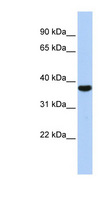 EXOSC2 / RRP4 Antibody - EXOSC2 / RRP4 antibody Western blot of HepG2 cell lysate. This image was taken for the unconjugated form of this product. Other forms have not been tested.