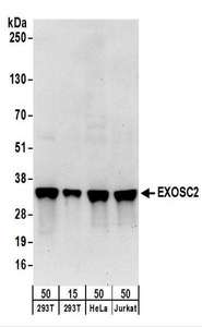EXOSC2 / RRP4 Antibody - Detection of Human EXOSC2 by Western Blot. Samples: Whole cell lysate from 293T (15 and 50 ug), HeLa (50 ug), and Jurkat (50 ug) cells. Antibodies: Affinity purified rabbit anti-EXOSC2 antibody used for WB at 0.4 ug/ml. Detection: Chemiluminescence with an exposure time of 30 seconds.